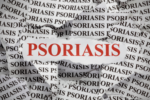 Psoriasis